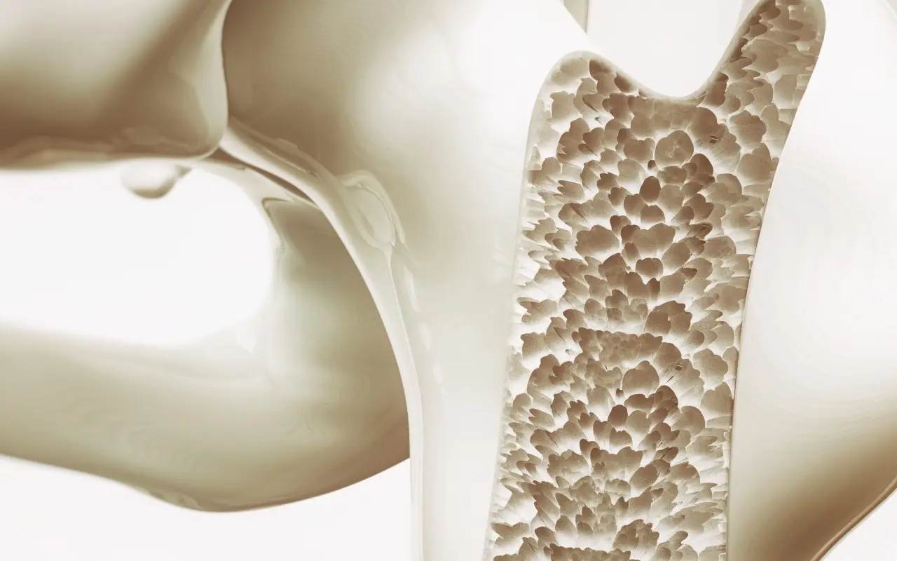 Che cos’è l’osteoporosi? Ecco i sintomi e le cause che non dovresti mai trascurare